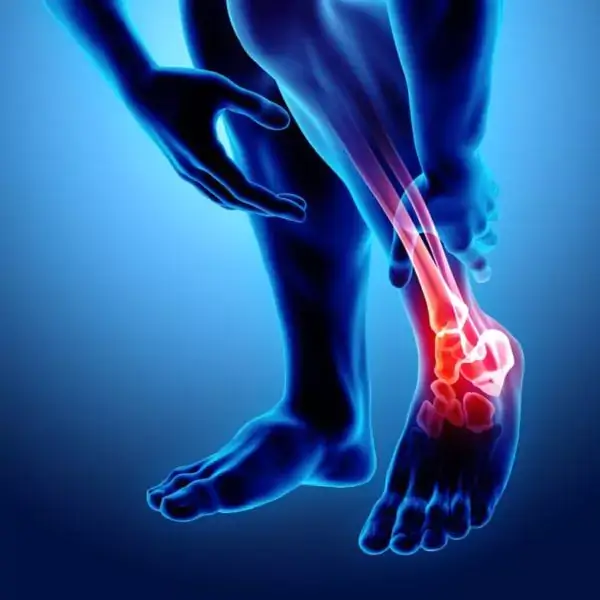 fracture ankle treatment