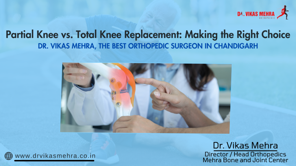 Partial Knee vs. Total Knee Replacement: Making the Right Choice